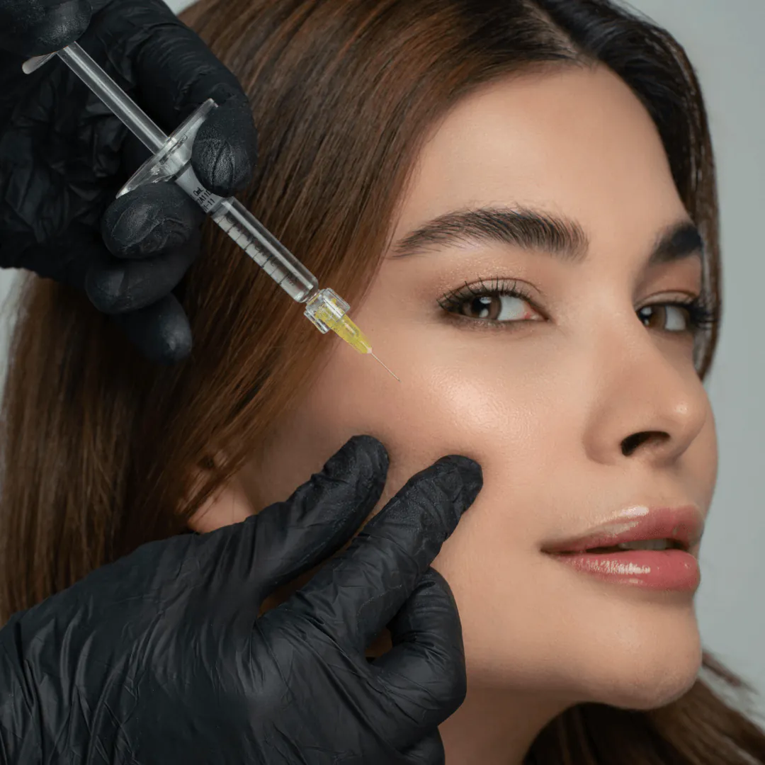 Bioestimuladores de colágeno aplicados por médica dermatologista na Prestige Clinique em Itaboraí