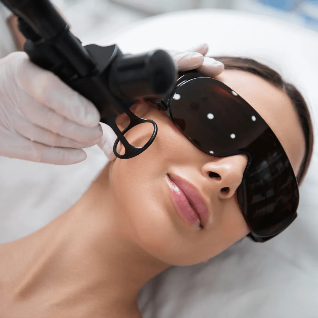 Laser de CO₂ fracionado para linhas finas, cicatrizes de acne e uniformidade do tom da pele